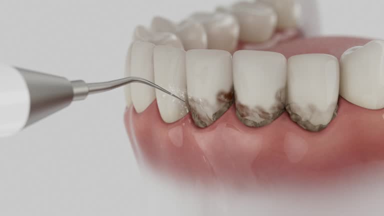 Reliable Dental Implants contractor in Linn, MO by Smile Center Dentistry